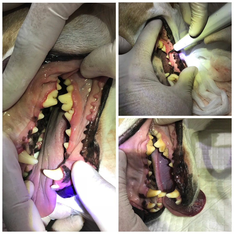 Detartraj cu ultrasunete